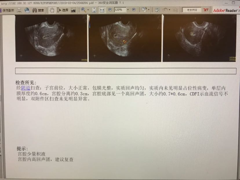 子宫内膜癌彩超图片