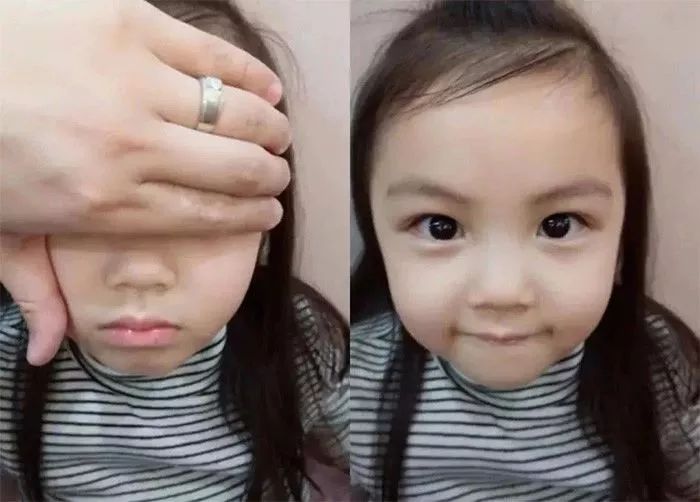 一双眼睛可以毁掉一张脸,也能拯救一张脸-聂丽丽主治医师-爱问医生