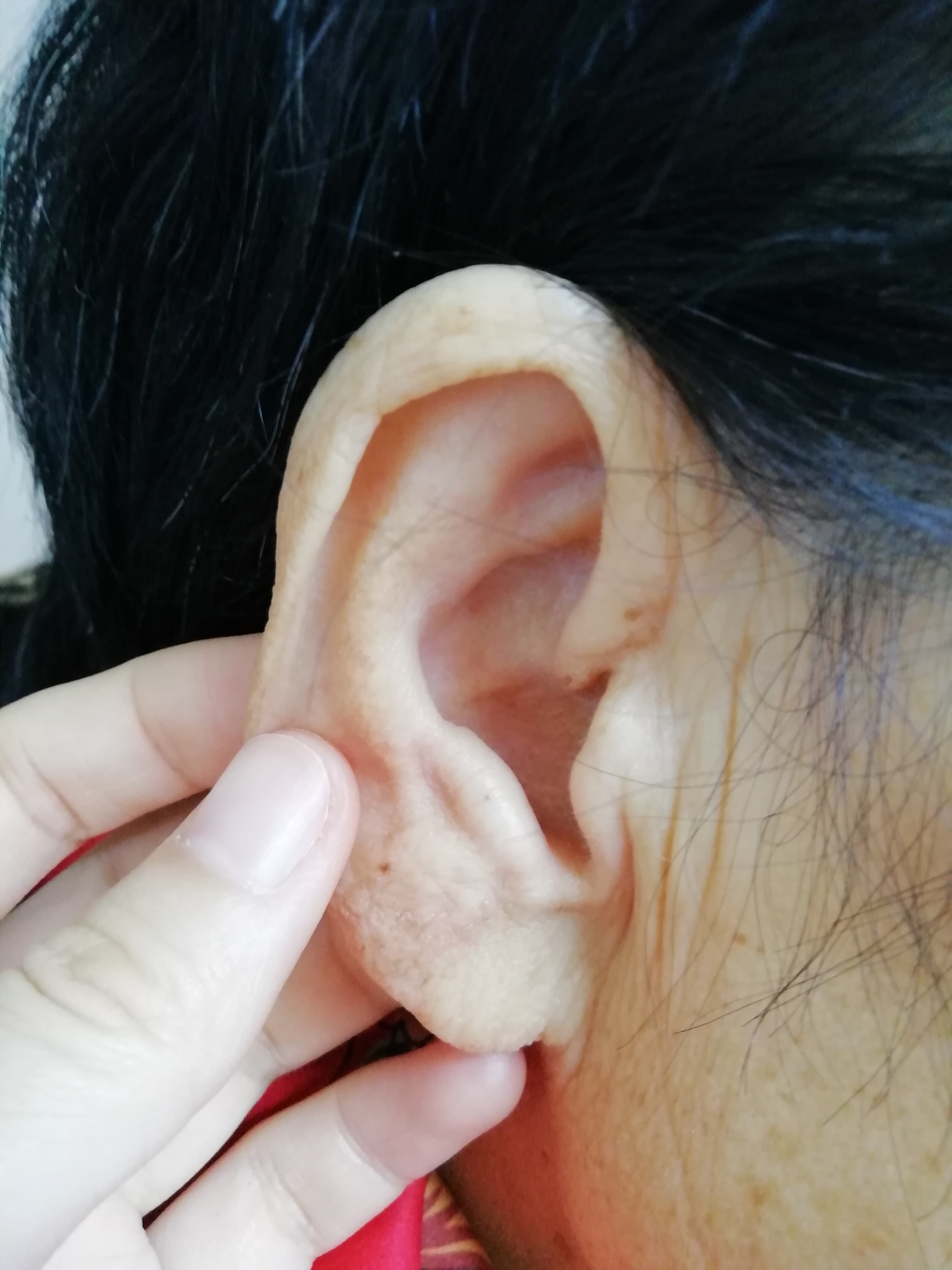 观耳识病头晕