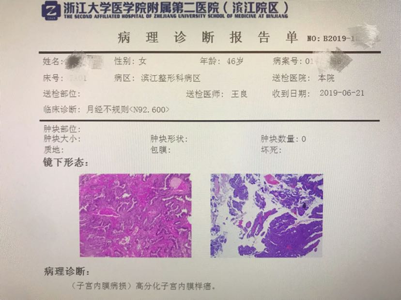 诊间日记 子宫内膜癌