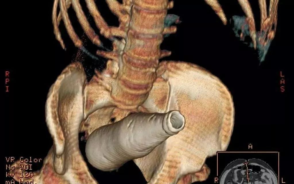 那些曾经被塞进肛门的东西!