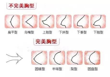 当然,选择什么样的假体,怎样的形状最适合自己,还得看专业专家经过