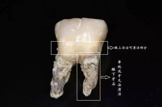 牙齿的牙成语疯狂猜成语_经轮成语疯狂猜成语(3)