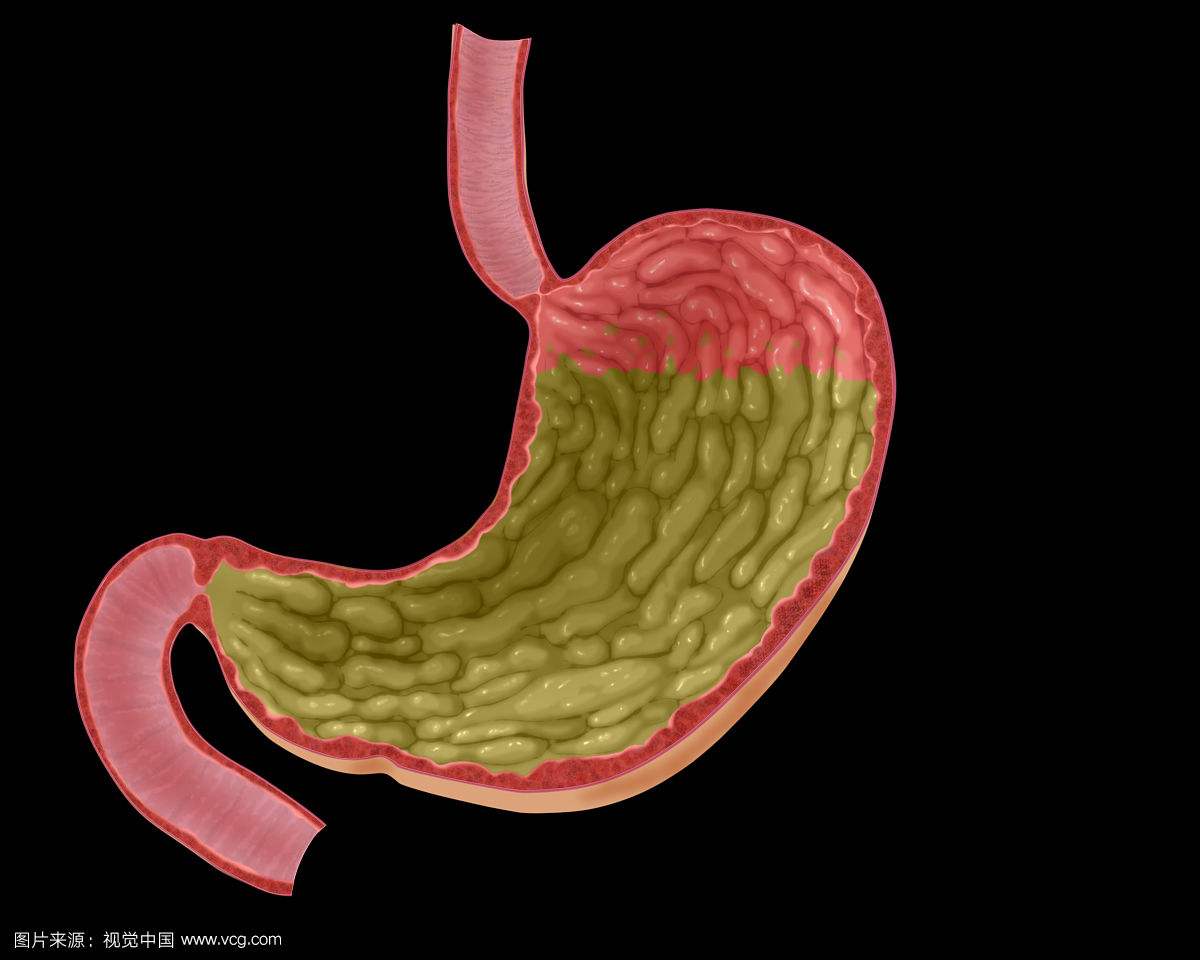 四种胃内小病一定要定期体检医生说这三类食物一定不能吃