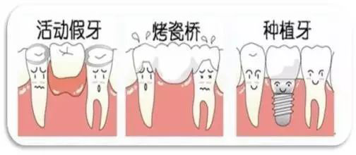 維港口腔種牙好