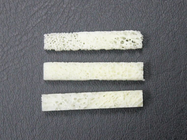 什么是异体骨隆鼻