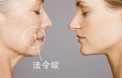 法令纹好可怕 90后都等不及要抗初老了