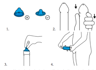 安全套(套套)的故事