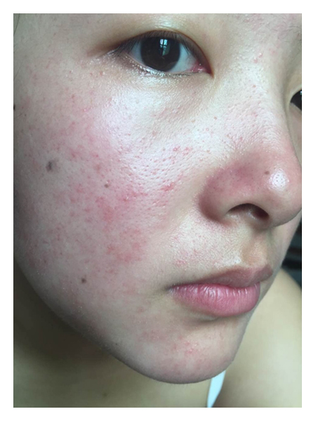 谢谢你透过敏感肌,看穿我脆弱的心