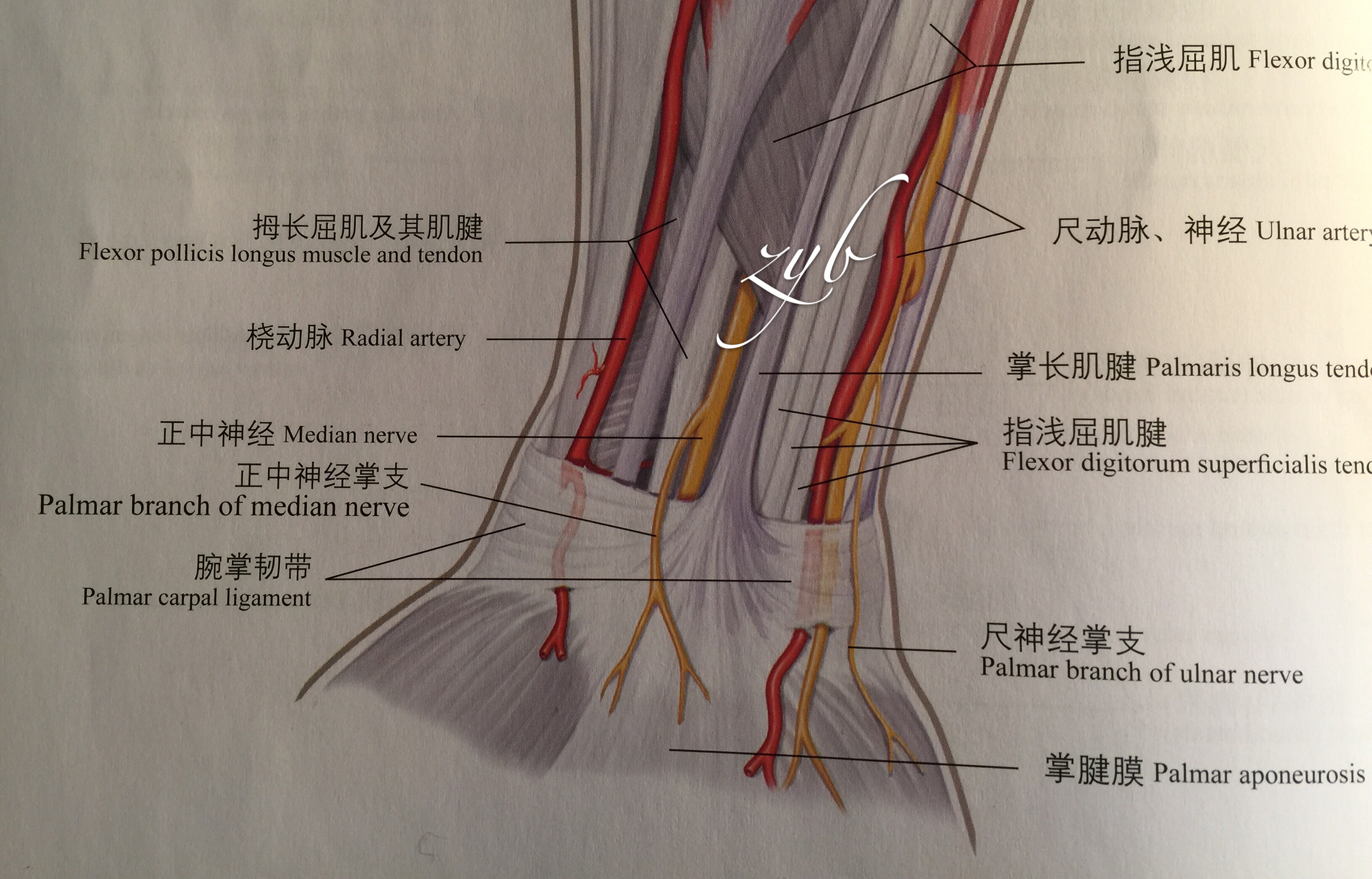 (腕部掌側解剖↑)(已縫合好的內部斷裂組織↑)而後迅速予以該患者輸血