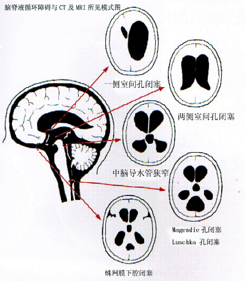 哎呀这么大脑袋里装的都是水