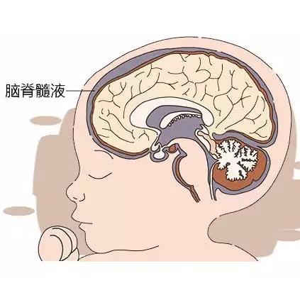 实际上属于硬膜下积液的一种表现