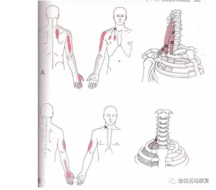 小肌肉大功能——斜角肌
