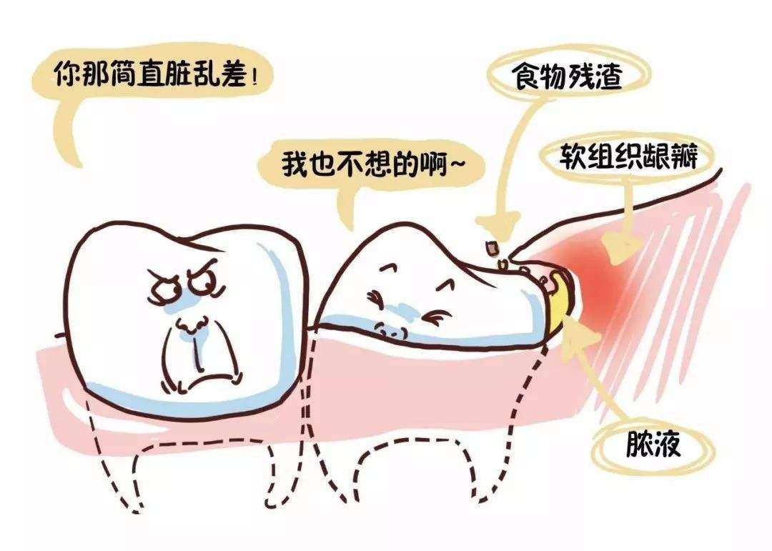 不容小觑——塞牙也是病