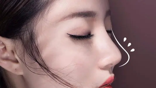 不要一味追求高翘挺的"网红鼻",否则...-李昕-爱问医生