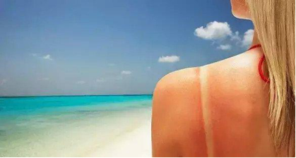 紫外线引起皮肤损伤主要分为晒伤和晒黑-王玮蓁主任医师-爱问医生