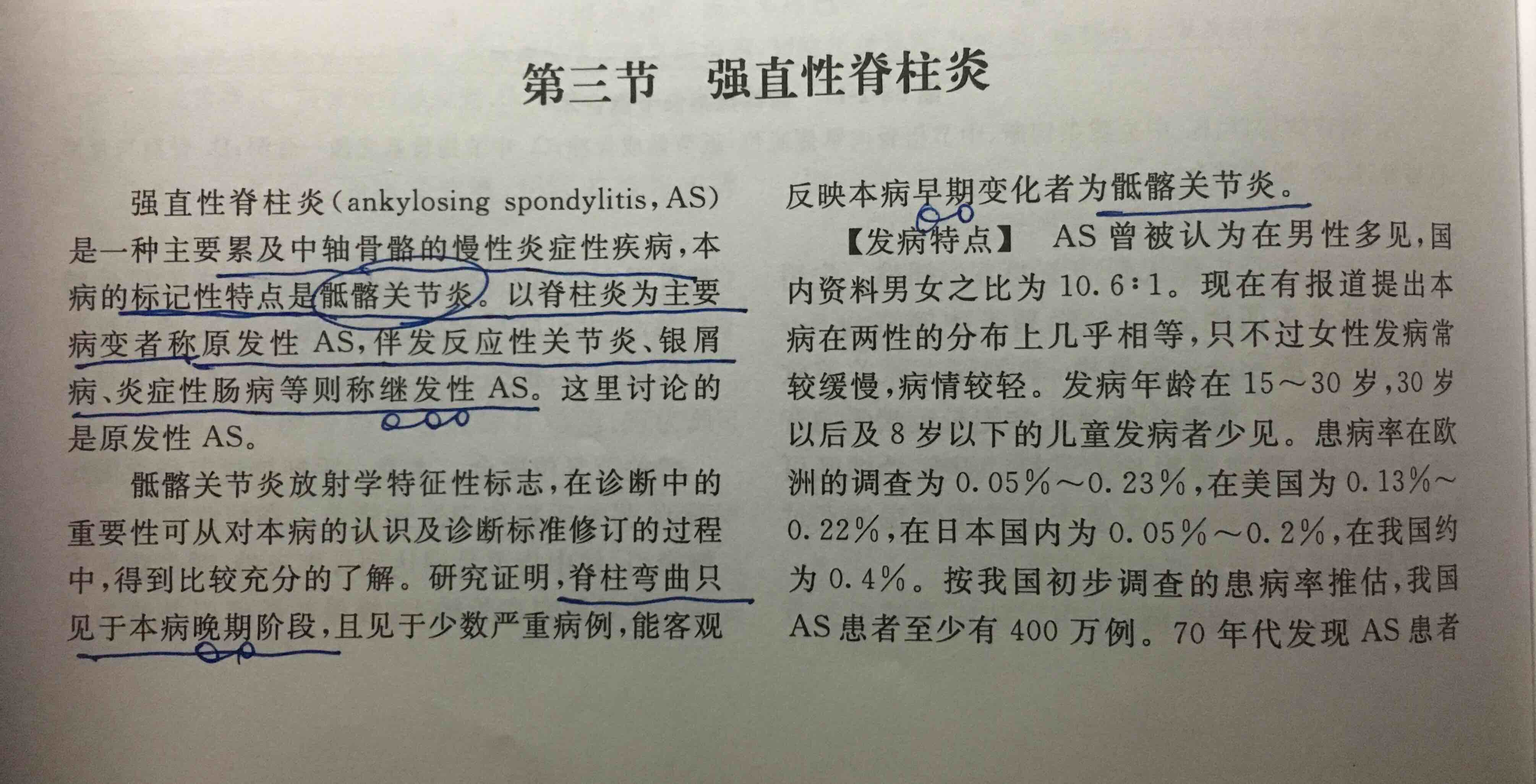 強直性脊柱炎知多少