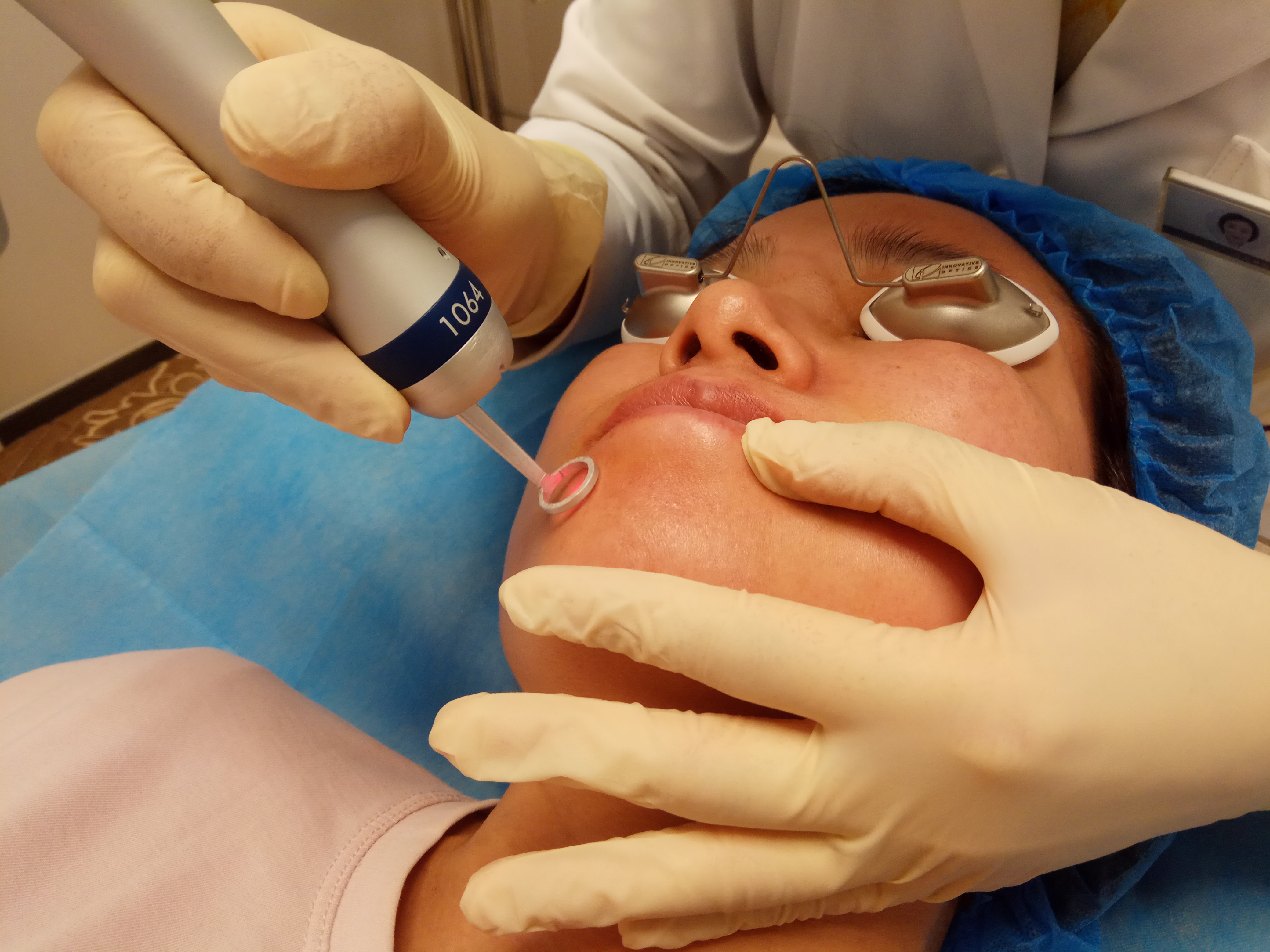 分不清雀斑与黄褐斑?需要看看这里