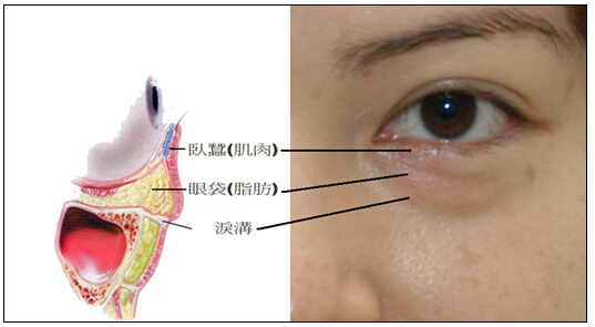 泪沟填充,没那么简单!