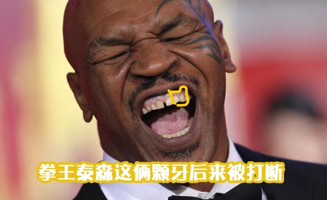 在大部分搏击比赛中,头部都是主要的攻击目标,当面部,下颌,两腮被击中