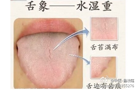 教你识舌像诊断治疗疾病