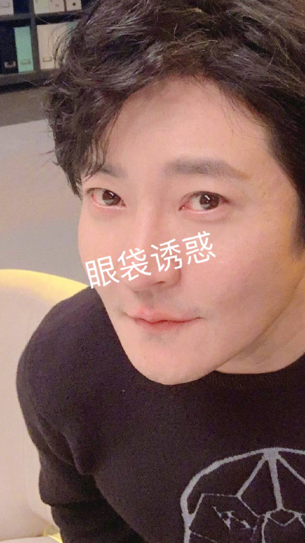 今天郭京飞祛眼袋术后第四天出血上热搜了,大家肯定很好奇术后到底