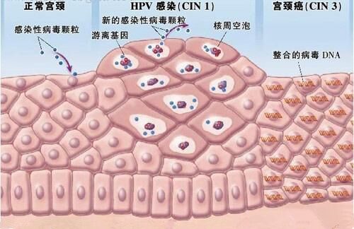 cinⅠ,Ⅱ,Ⅲ都是什麼意思?