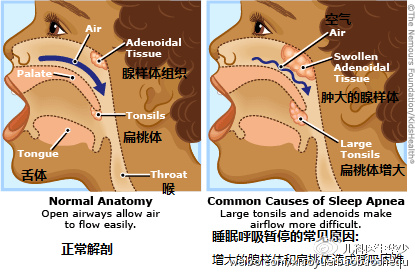 寶寶為什麼睡覺打鼾(打呼嚕)?