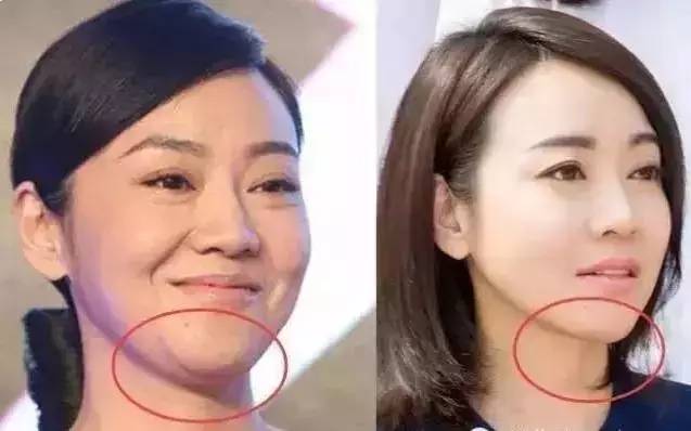 好美!闫妮的微整,简直改变了整个人!