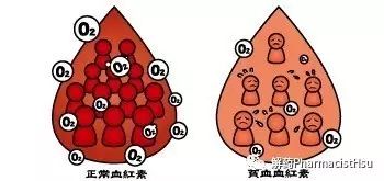 試著想一下,鐵作為合成血紅蛋白原材料和修復粘膜的原材料被工廠訂購