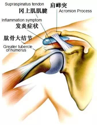 你能在网上看到最干的干货:使用肩肱节律处理肩痛?