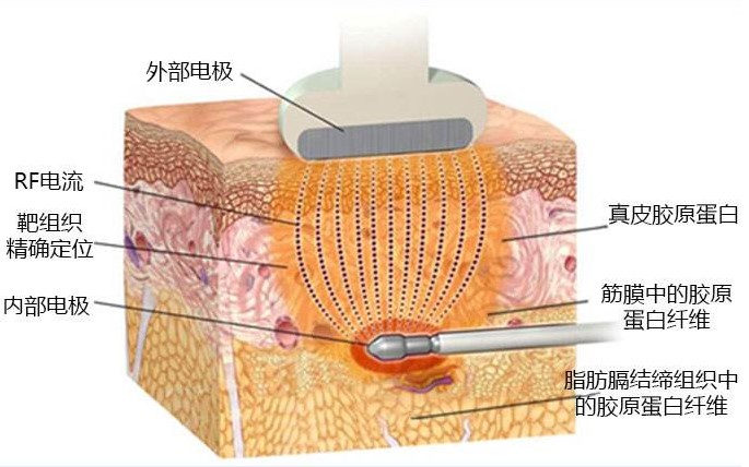 黄金微雕手术过程图片