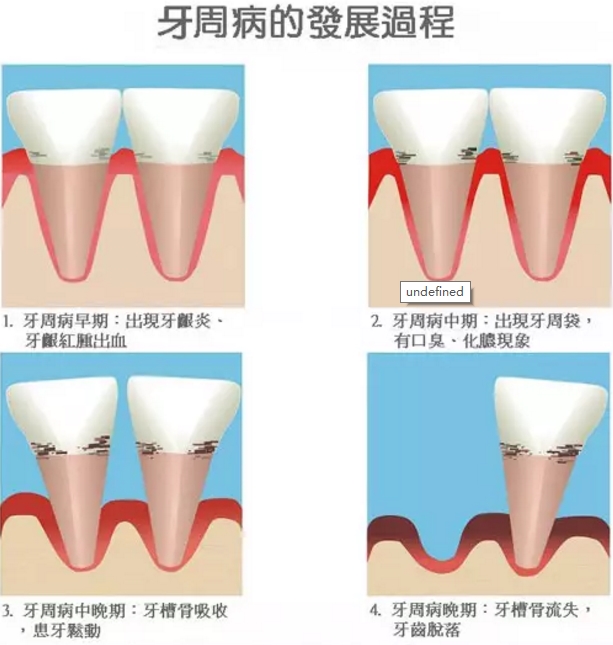 什么原因造成牙龈出血?