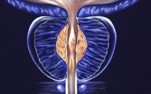 前列腺钙化灶怎么治疗图片