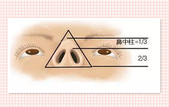 国人多数存在鼻中隔发育不良和鼻小柱过短的问题,其实正常的鼻小柱和