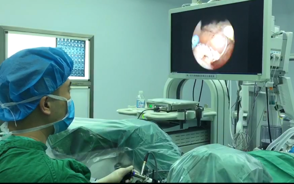 一例经尿道前列腺等离子电切术(pkrp)