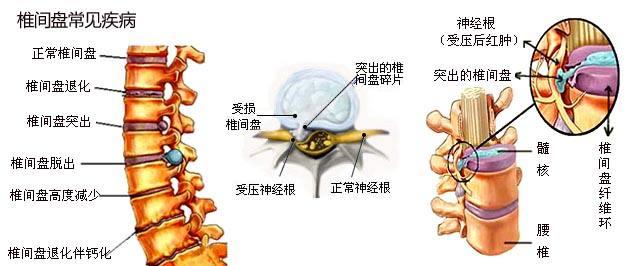 达到锻炼腰背肌,缓解腰部等部位的劳损等目的,明白了小燕飞的锻炼原理