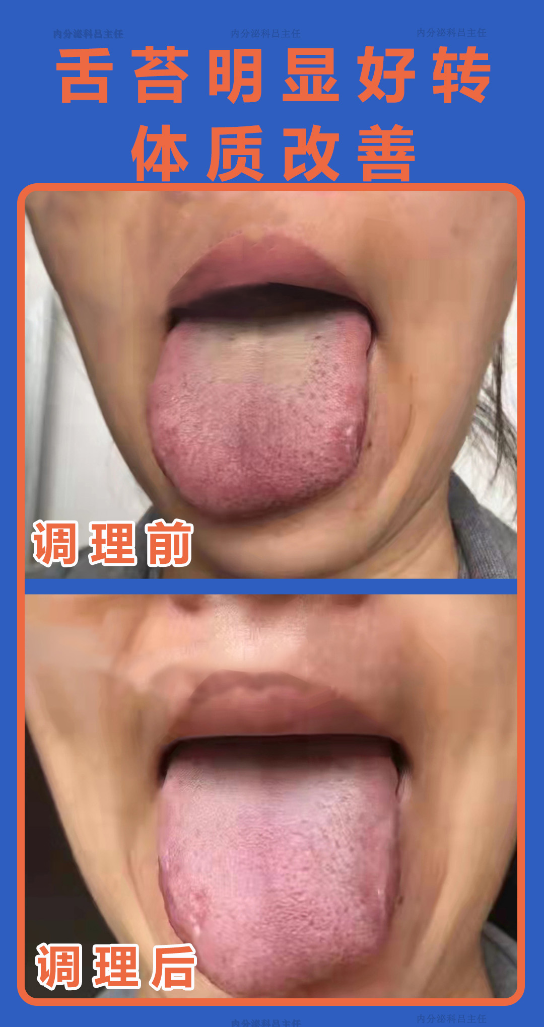 辨舌苔 调体质 散结节 吕久省主任医师 爱问医生