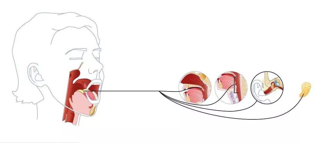 舌咽神经痛是普通的嗓子疼吗?