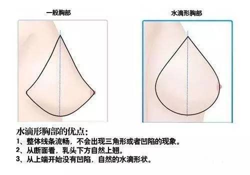 隆胸效果好不好关键在于这三感