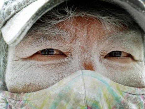 不吸烟也能得肺癌别忽略这几个因素