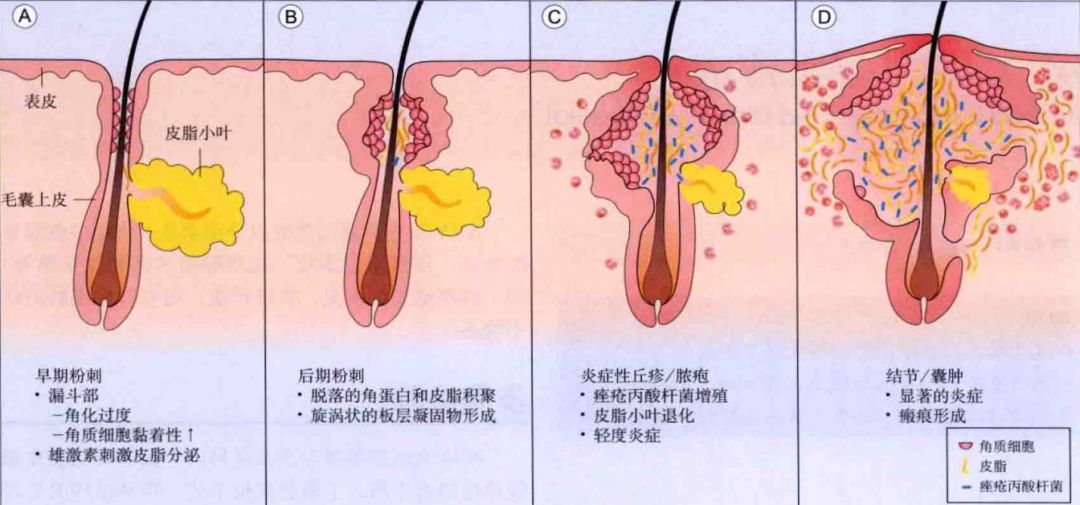 皮脂腺具体位置图片