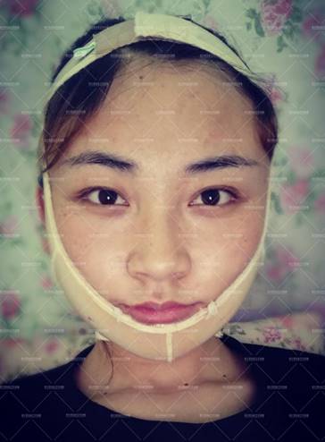 改脸型磨骨瘦脸手术到底疼不疼?