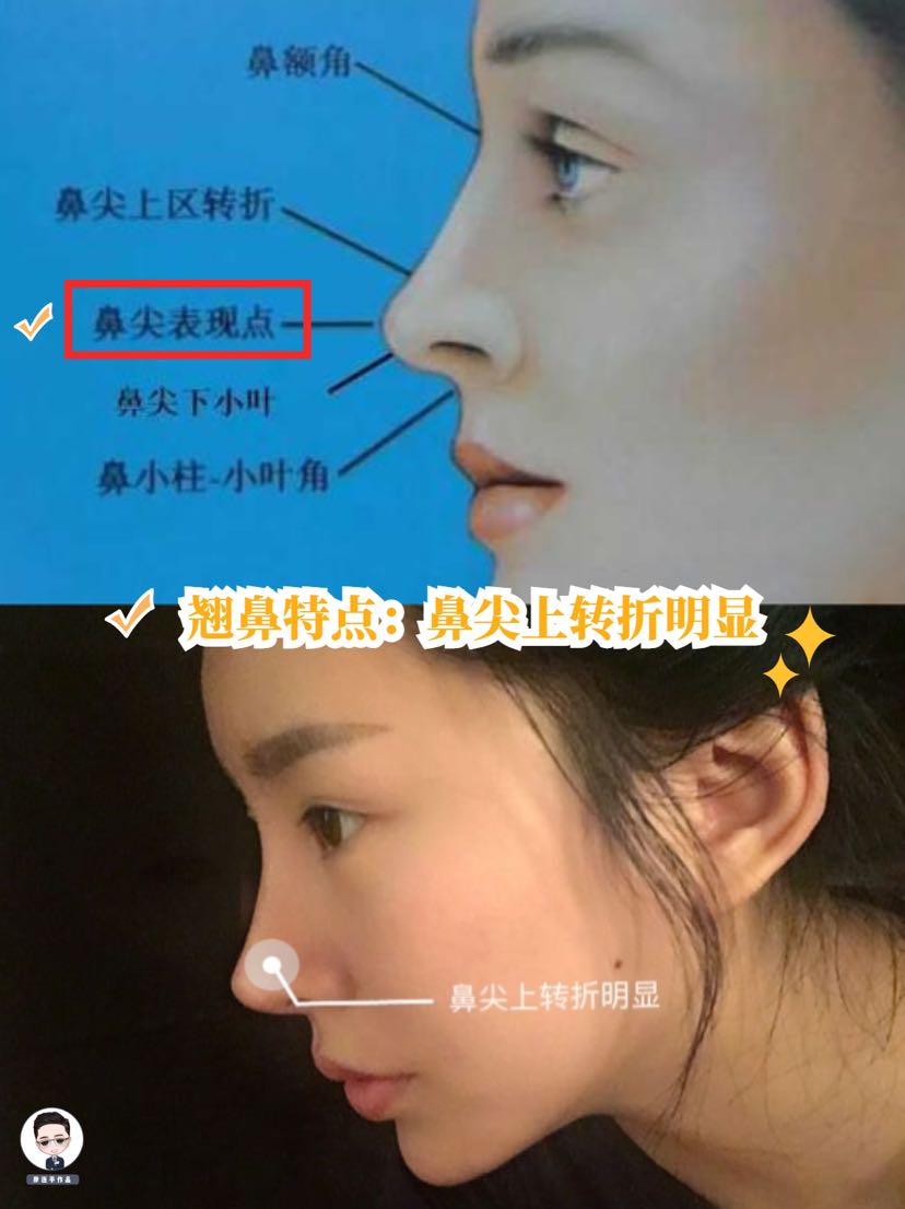 整形功课如何做二鼻部审美功课上