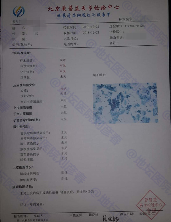 【病例分享】每个女孩都应该引起重视----宫颈癌的年轻化趋势