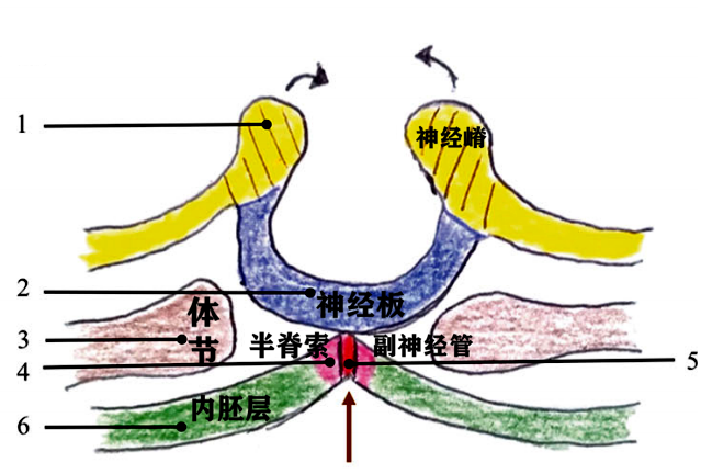文献查阅丨脊髓纵裂畸形
