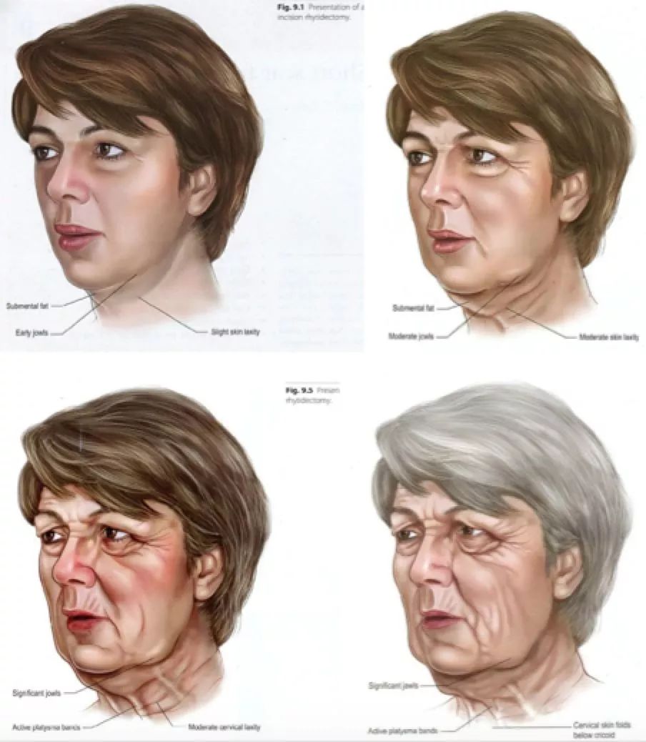 我们是怎样一步步衰老的?