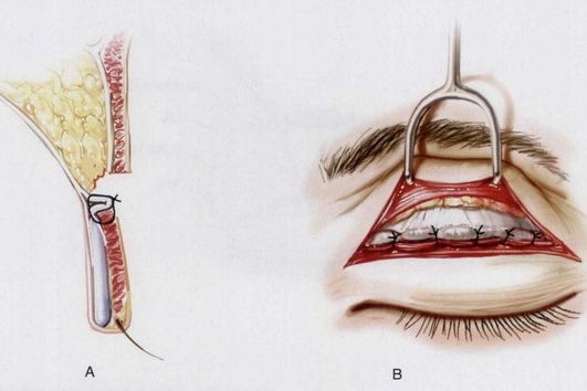 operation preparation
