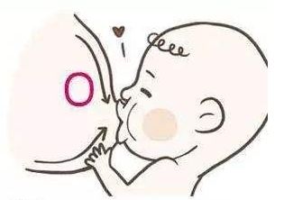 乳头凹陷怎么办