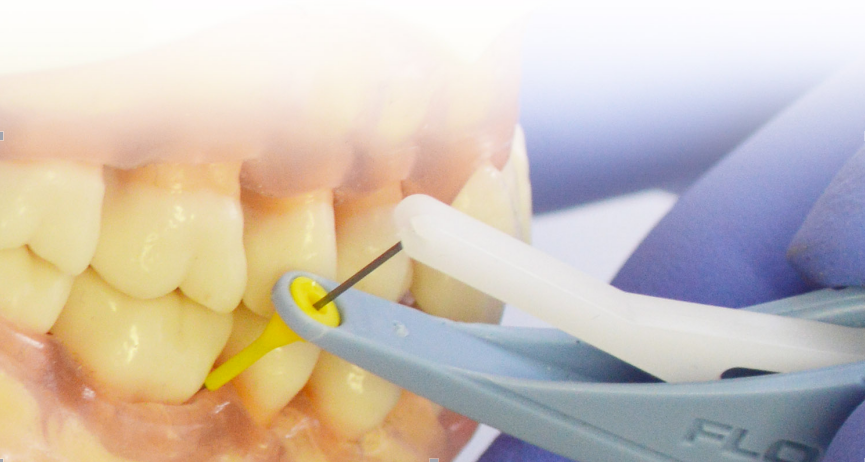 15g的标准化探诊力量,完全避免了传统探针对牙周组织的损伤,你只会